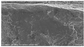 圖11-154 斷面A1、A2區(qū)邊沿微觀形貌